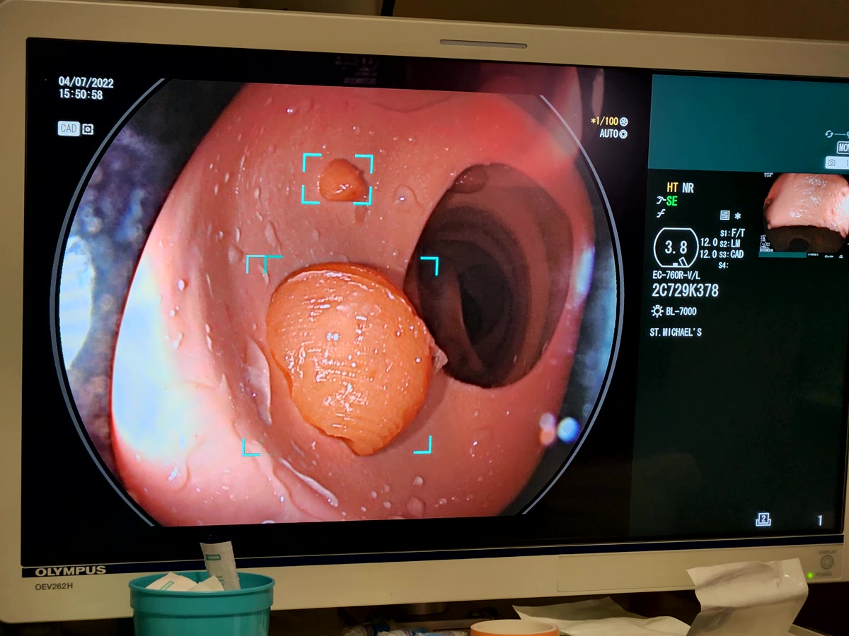 AI in medical education